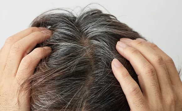 【画像】30歳で白髪まみれのワイ、終わる・・・・・