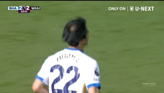 【画像】三笘の頭皮、限界突破ｗｗｗｗｗｗｗｗｗｗ