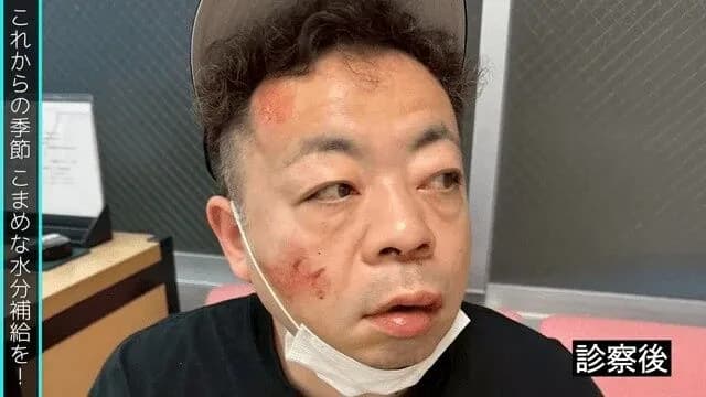 ダイアン、熱中症で死にかける