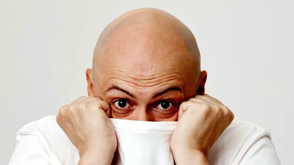 【疑問】20代でガッツリハゲたんやが人生どうすればええ？