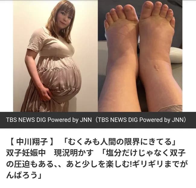 【画像】中川翔子さん、足もパンパンに「むくみもひどくて人間の限界にきてる」