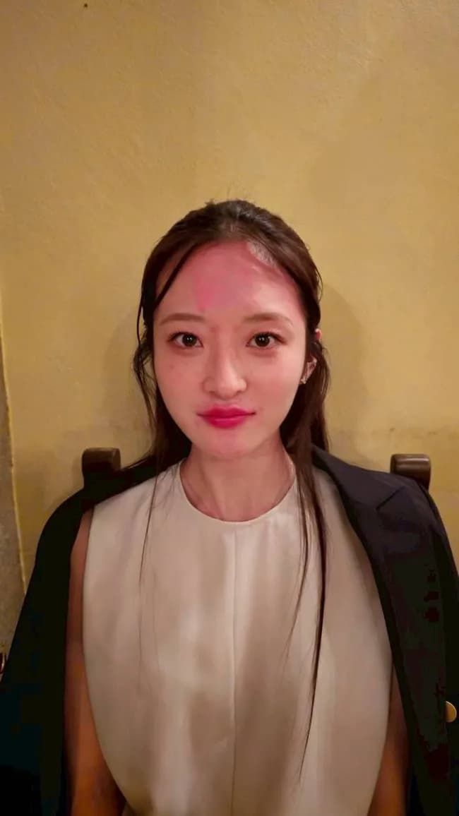 【画像】ミス東大「お酒飲むと顔面に蕁麻疹でちゃう！」←だいぶやばいと話題に