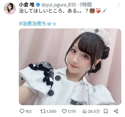 【画像】小倉唯(30)「治してほしいところ、ある。。？」