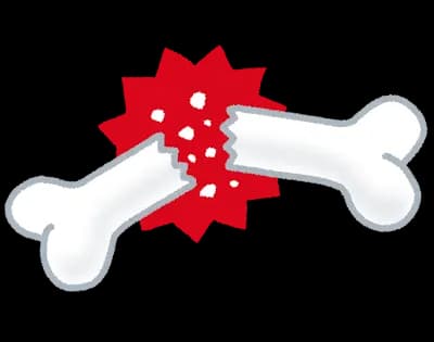 「腕折るけどいくら？」と富豪から…美女インフルエンサーが“ドバイ案件”の過酷な実態を暴露→動画が即非公開、「闇すぎ」とネット騒然