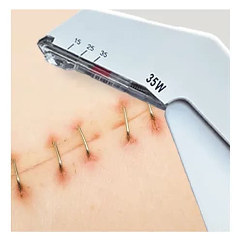 【画像】医療用ホッチキス、絶対痛い