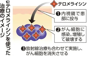 【朗報】癌細胞だけを殺すウイルスを岡山大が発見！治療薬として既に厚労省に申請済みｗｗｗｗｗ