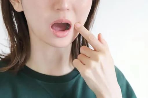 【急募】親知らずを抜くんやが痛いんか？ｗｗｗｗｗｗｗｗｗｗｗｗｗｗｗｗ