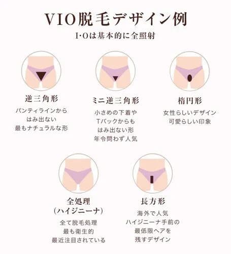 【悲報】最近の若い女さん、マ◯毛を処理しすぎてしまうｗｗｗｗｗｗｗｗｗｗ