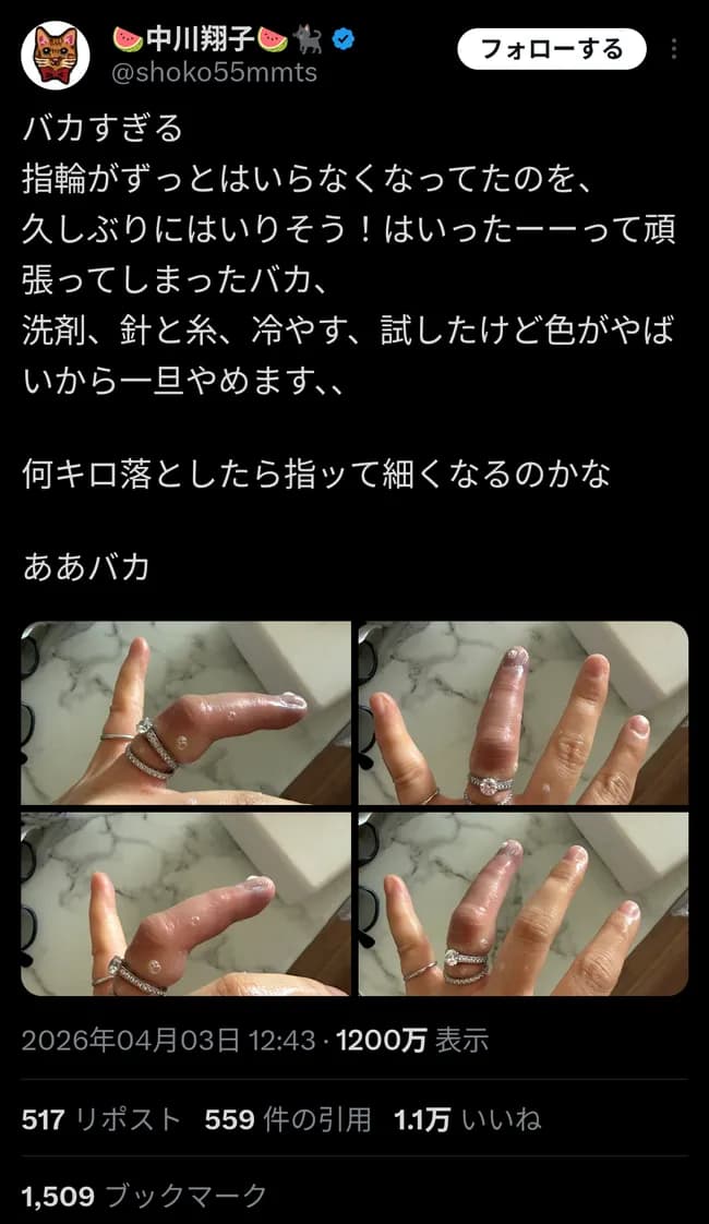 【悲報】中川翔子さん、とんでもないことになってしまう・・・・・