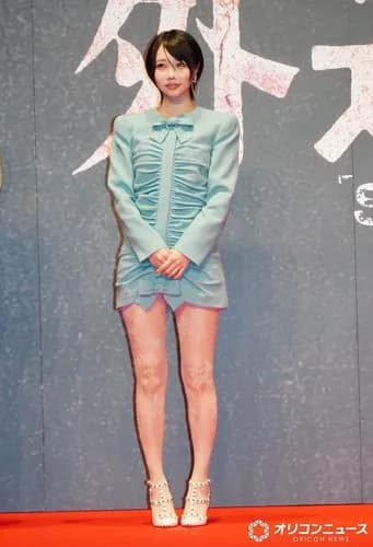 【画像】あのちゃんさん、超ミニ丈ワンピ×レア横分けヘアを披露した結果ｗｗｗｗｗｗｗｗｗｗ