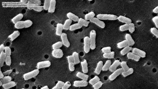 【悲報】高校生170人、修学旅行で血便