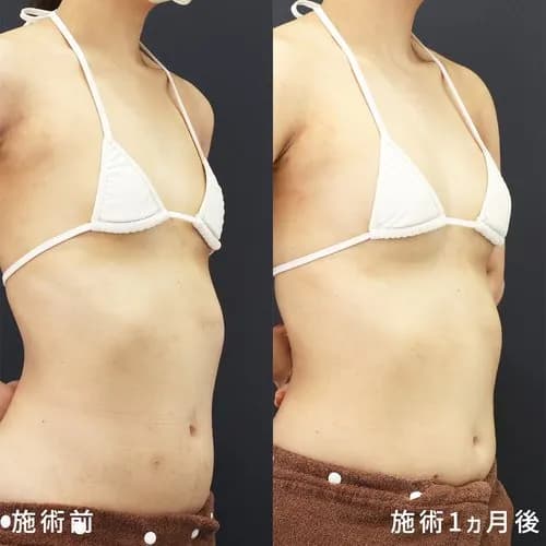 【悲報】AV女優みひなさん、おっ◯いを大きくして改名して再デビュー・・・・・・・・・