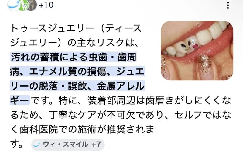 【悲報】歯ジュエリーさん、ガチで本格的に流行ってしまうｗｗｗｗｗｗｗｗｗｗ