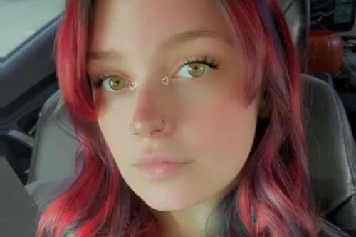 【閲覧注意】てんかん発作で気絶した女性さん、飼っていたピットブルに顔を食べられてしまう・・・・・・・・・