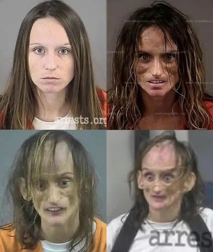 【画像】覚醒剤を15年間キメ続けた女性さんの風貌がガチでヤバすぎるｗｗｗｗｗｗｗｗｗｗ