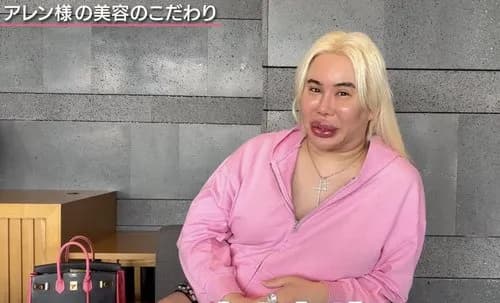 【悲報】整形に1億円以上費やしたアレン様、月150万かけて「今の顔をキープしないと」ｗｗｗｗｗｗｗｗｗｗ