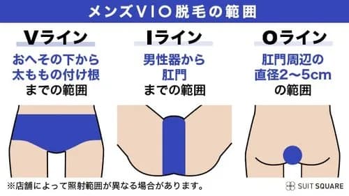 【悲報】VIO脱毛、ガチでエッッッすぎるｗｗｗｗｗｗｗｗｗｗ