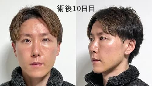 【悲報】男配信者さん、40代に突入した瞬間ガチで別人になってしまうｗｗｗｗｗｗｗｗｗｗ