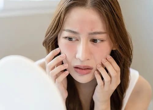 【悲報】欧米の白人さん「日焼けした方が健康的」←皮膚がん発生率が世界屈指の模様ｗｗｗｗｗｗｗｗｗｗ