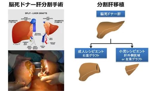 【狂気】人類さん、ついに気づいてしまう「遺伝子操作で頭のない人体を量産して臓器取り出せばよくね？」ｗｗｗｗｗｗｗｗｗｗ