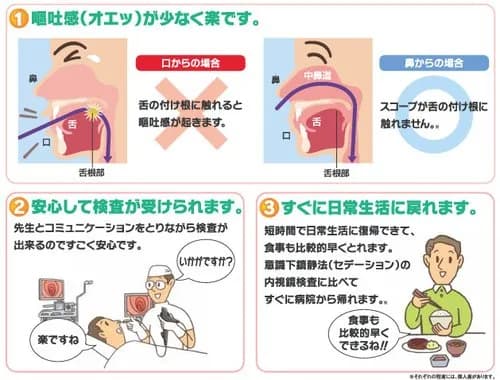【困惑】胃カメラさん、鼻から入れるか口から入れるか問題ｗｗｗｗｗｗｗｗｗｗ