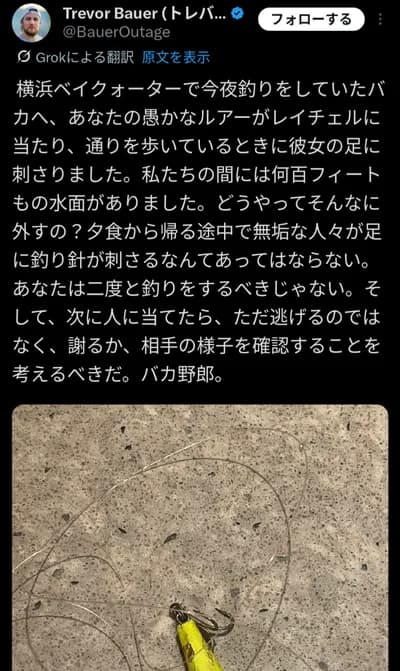 【悲報】バウアー、代理人の足にルアーが刺さりブチギレ