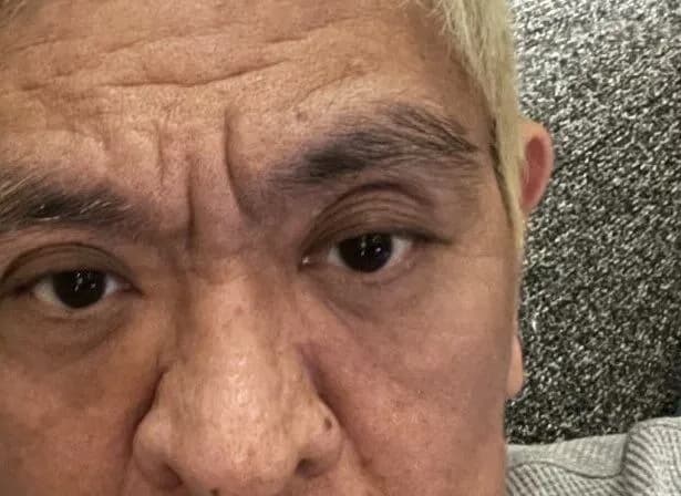 【画像】松本人志さん、まぶたの枚数が多い　想像の数枚多い