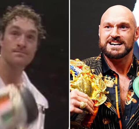 スポーツ選手に「本物のハゲ」って居なくね？