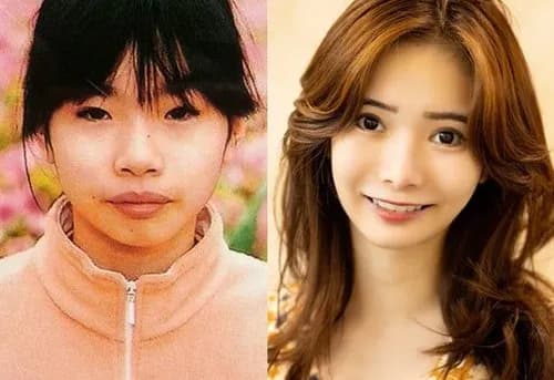 【悲報】カリカリ女さん、見た目エイリアンなのに大金払って整形してしまうwwwwwwwwww